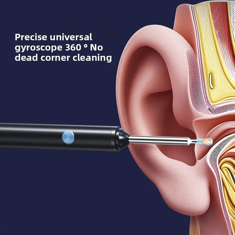 Clenova Earsight Pro - The Smart Way to Clean Your Ears.